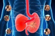 Желчная колика: как распознать симптомы, пока боль не заставит бежать в скорую